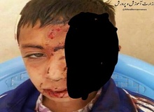 سقوط دانش آموز از کوه به خاطر شبکه شاد/ آموزش و پرورش: برای چیدن گل زعفران رفته بود!