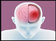کمبود این ویتامین مغز را کوچک می‌کند
