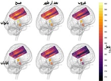 مغز زنان داغ تر از مردان است!/ یک کشف جالب در نقشه۴ بعدی دمای مغز(+عکس)