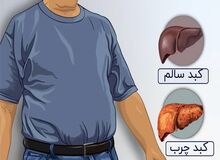 کبد چرب غیرالکلی چیست و چه بلایی سرتان می‌آورد؟