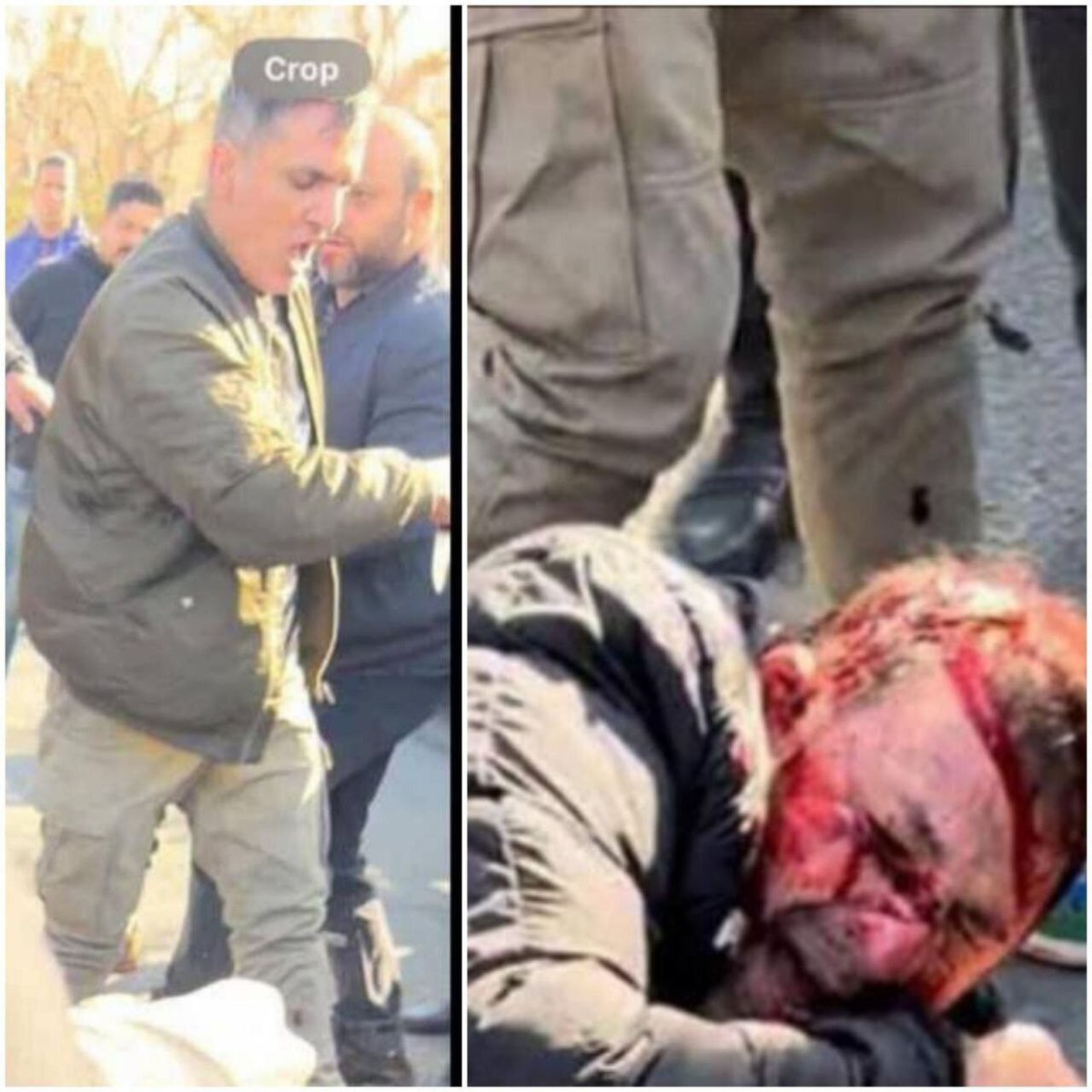 اولین تصویر از صورت خونین هانی کرده/عکس فرد تیرانداز و لحظه تیراندازی