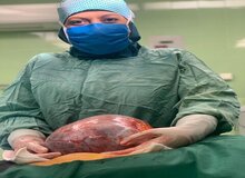 خارج کردن توده ۵ کیلویی از شکم زن اسدآبادی+تصویر