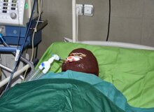 اسیدپاشی هولناک روی پدر و دختر در تهران/ انگیزه همسایه اسیدپاش چه بود؟