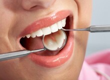 بیماری‌های لثه باعث مرگ زودهنگام زنان می‌شود