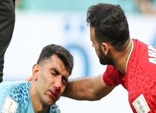 بیرانوند جام جهانی را از دست داد