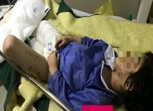 جزئیات تکان دهنده جدید از حادثه کودک آزاری در مهاباد/ والدین معتاد؛ متهمان اصلی/ شکنجه 2 ماهه دلیل وحشت کودک از اطرافیان+ عکس