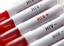 واکنش مقام وزارت بهداشت به محرمانه بودن اطلاعات تست HIV