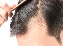 آیا کراتین باعث ریزش مو می‌شود؟