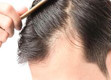 آیا کراتین باعث ریزش مو می‌شود؟