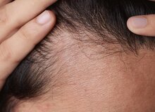 چگونه از آسیب‌دیدگی موها پیشگیری کنیم؟
