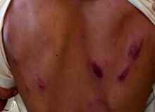 تنبیه وحشتناک دانش آموز فنوجی توسط معلم / دبیر خاطی: به علت رعایت نکردن سکوت، کنترل خود را از دست دادم !+عکس 