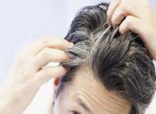 شناسایی ۶ وضعیت پزشکی از ظاهر موی سر
