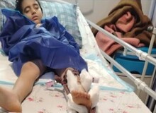 ناظم برای پاشیدن چندقطره آب روز لباسش ران و لگن دانش آموز را شکست