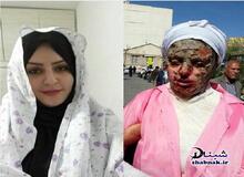 دختر قربانی اسیدپاشی: دکتر گفته گریه نکنم چون اشک برای پوستم ضرر داره/خواهرجان تو بگو خوب می شم؟
