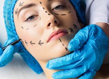 بحران عظیم ژل فله‌ای تقلبی روی صورت مردم/ اکثر مطب‌ها و کلینیک‌های زیبایی غیرمجاز هستند