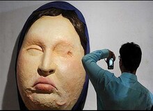 صدور حکم دیه در پرونده اسیدپاشی اصفهان
