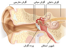 پارگی پرده گوش درمان دارد