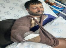 جراحت محیط‌بان اصفهانی با شلیک مستقیم شکارچی غیرمجاز