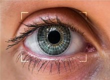 تغییر رنگ چشم؛ یک جراحی زیبایی پرطرفدار