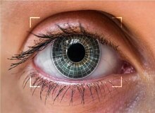 تغییر رنگ چشم؛ یک جراحی زیبایی پرطرفدار