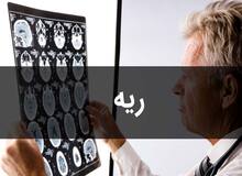 فوق تخصص بیماری‌های ریه: در فصل پاییز و زمستان، آنفلوآنزا هم به کرونا اضافه می‌شود/ PCR در بهترین شرایط می‌تواند تا ۶۰ درصد مثبت بودن کرونا را نشان بدهد