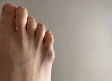 وظیفه بزرگِ انگشت کوچک پا / اگر نباشد چه می‌شود؟