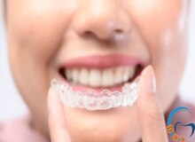 مراحل ارتودنسی دو فک چگونه است؟