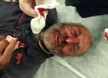 حمله پلنگ به یک چوپان در کجور مازندران