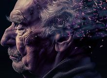 هوش مصنوعی فهم و درمان آلزایمر و پارکینسون را ممکن می‌سازد