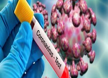 کدام مقامات کشور کرونا گرفته‌اند؟ + جدول
