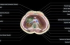 اسکن بدن بدون نیاز به دستگاه MRI / پروژه بلندپروازانه «میدجرنی مدیکال»