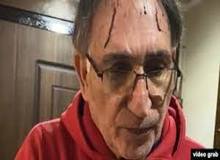 کیهان: قرمز بودن چند جای پیشانی نوری زاد، تلاش برای براندازی با گریم سس گوجه فرنگی بود