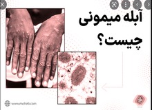 سازمان جهانی بهداشت شیوع «آبله میمون» را یک وضعیت اضطراری جهانی اعلام کرد 