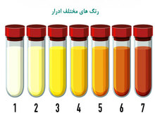 تغییر رنگ ادرار نشانه چیست؟
