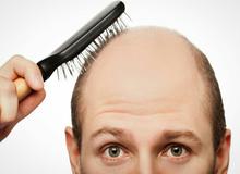 بهترین داروهای خوراکی ضد ریزش و پر پشت کردن مو را بشناسید