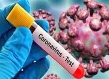 ظاهر متفاوت یک کارمند بانک پس از شیوع کرونا+عکس
