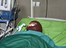 اسیدپاشی هولناک روی پدر و دختر