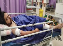 جزییات زورگیری خونین از یک عکاس خبری در تهران / ۲۱ ضربه چاقو زدند، لنز و لپ‌تاپ و دوربین را بردند