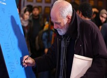 آیدین آغداشلو در بیمارستان آبان تحت عمل جراحی قرار گرفت