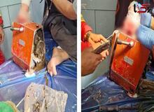 گیرکردن دست یک کارگر قصابی در دستگاه چرخ‌گوشت