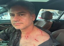 حمله سارقان موتورسوار به مربی تیم ملی در بزرگراه مدرس+ تصویر